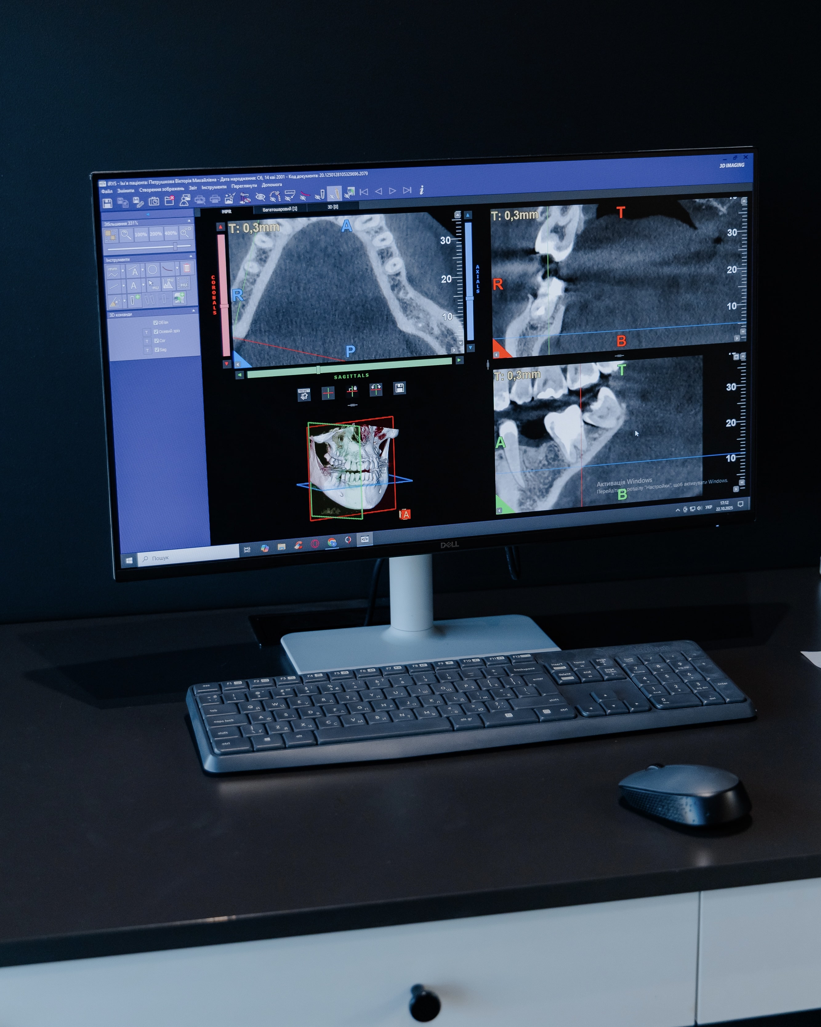 Діагностика