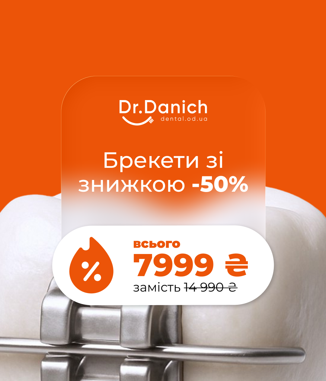 Брекети зі знижкою