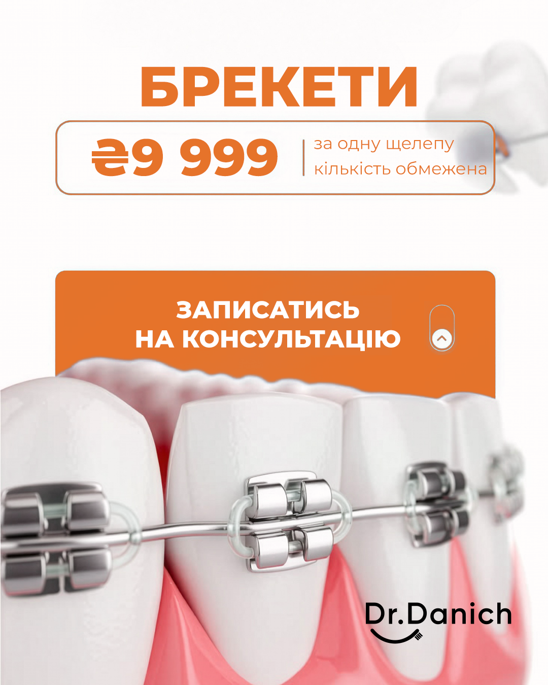 Брекети зі знижкою